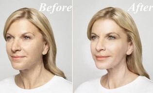 Before and after taking Goji Cream