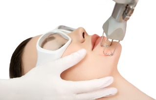Laser skin rejuvenation facial